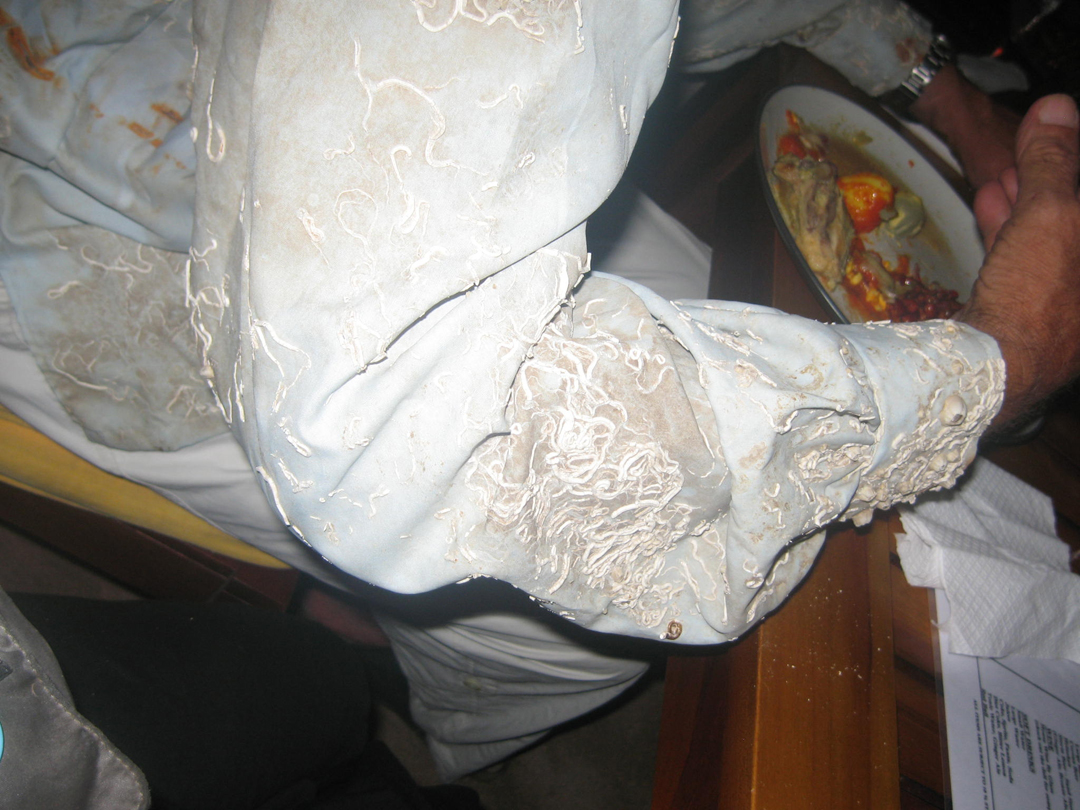 Detail of Wolf's Accreated Shirts